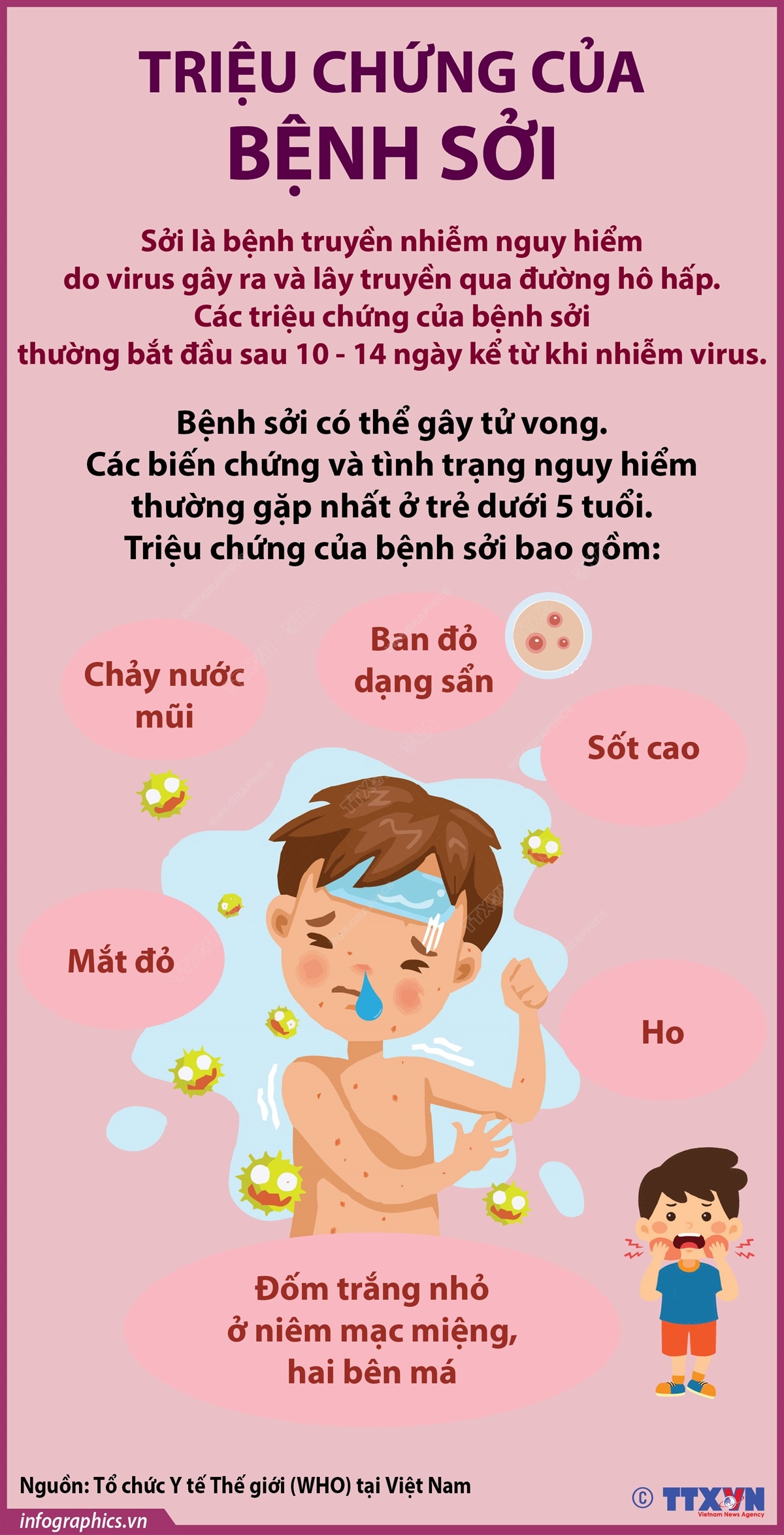 Phòng chống bệnh sởi năm 2025